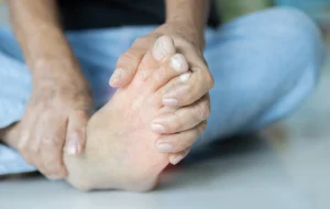 artritis reumatoide en pies