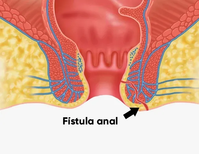 médico proctólogo